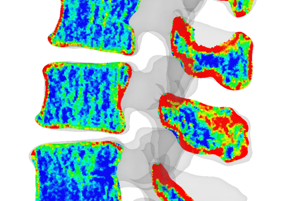 Density of FE model